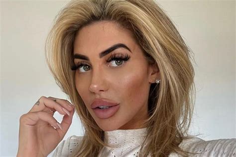 Geordie Shore's Chloe Ferry opens up about plastic 